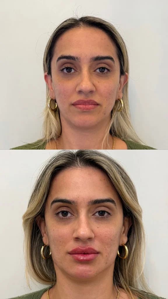 Dra Vanessa Bertoldi - Harmonização Facial e Estética – foto 3