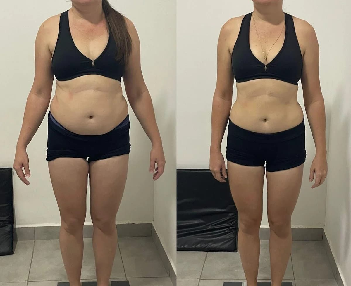 Clínica de Estética Avançada Fernanda Ferreira - Especialista em Diástase – foto 3