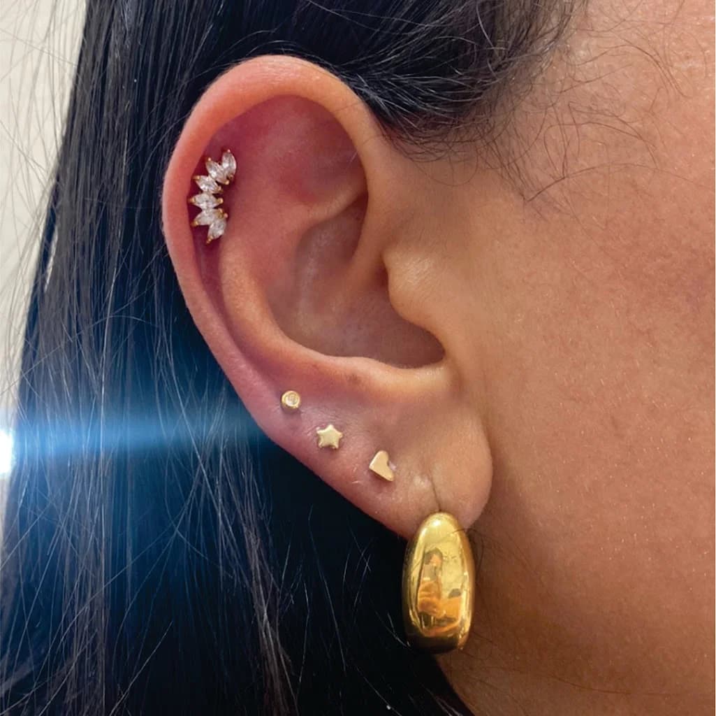 Amoras Estética Auricular e Avançada – foto 1