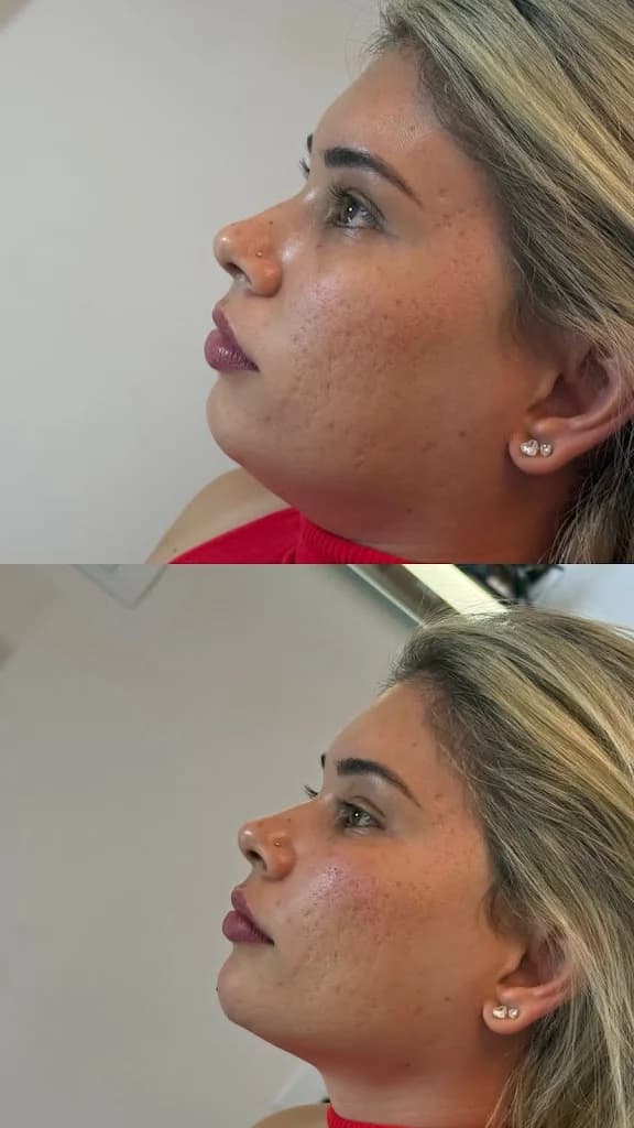 Dra. Laura Antognoli | Estética Avançada – foto 3
