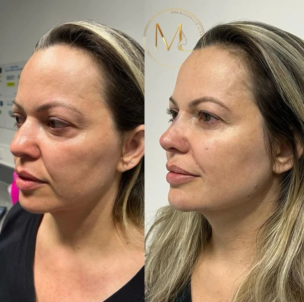 Dra. Michelle Lisboa - Harmonização Facial || Manaus – foto 1