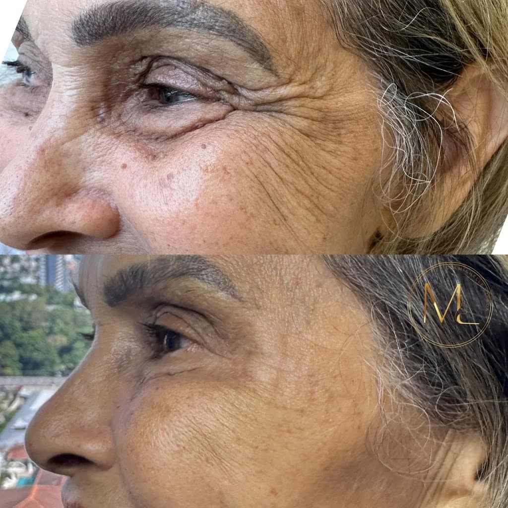 Dra. Michelle Lisboa - Harmonização Facial || Manaus