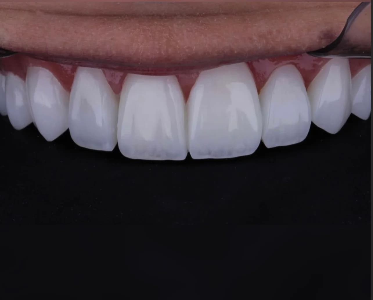 Dra Luhara Carvalho - Dentista em Cuiabá – foto 1
