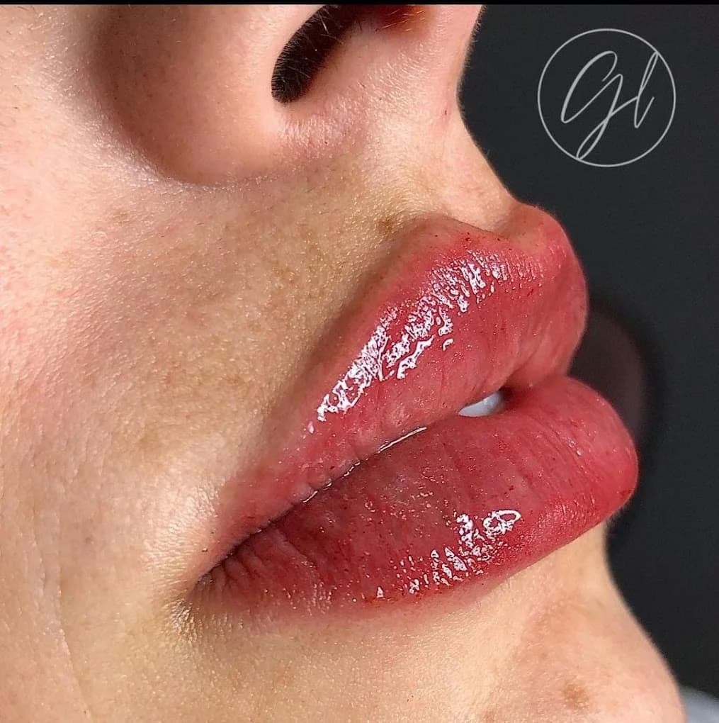 Laudeauser Clinic / Harmonização Facial – foto 1