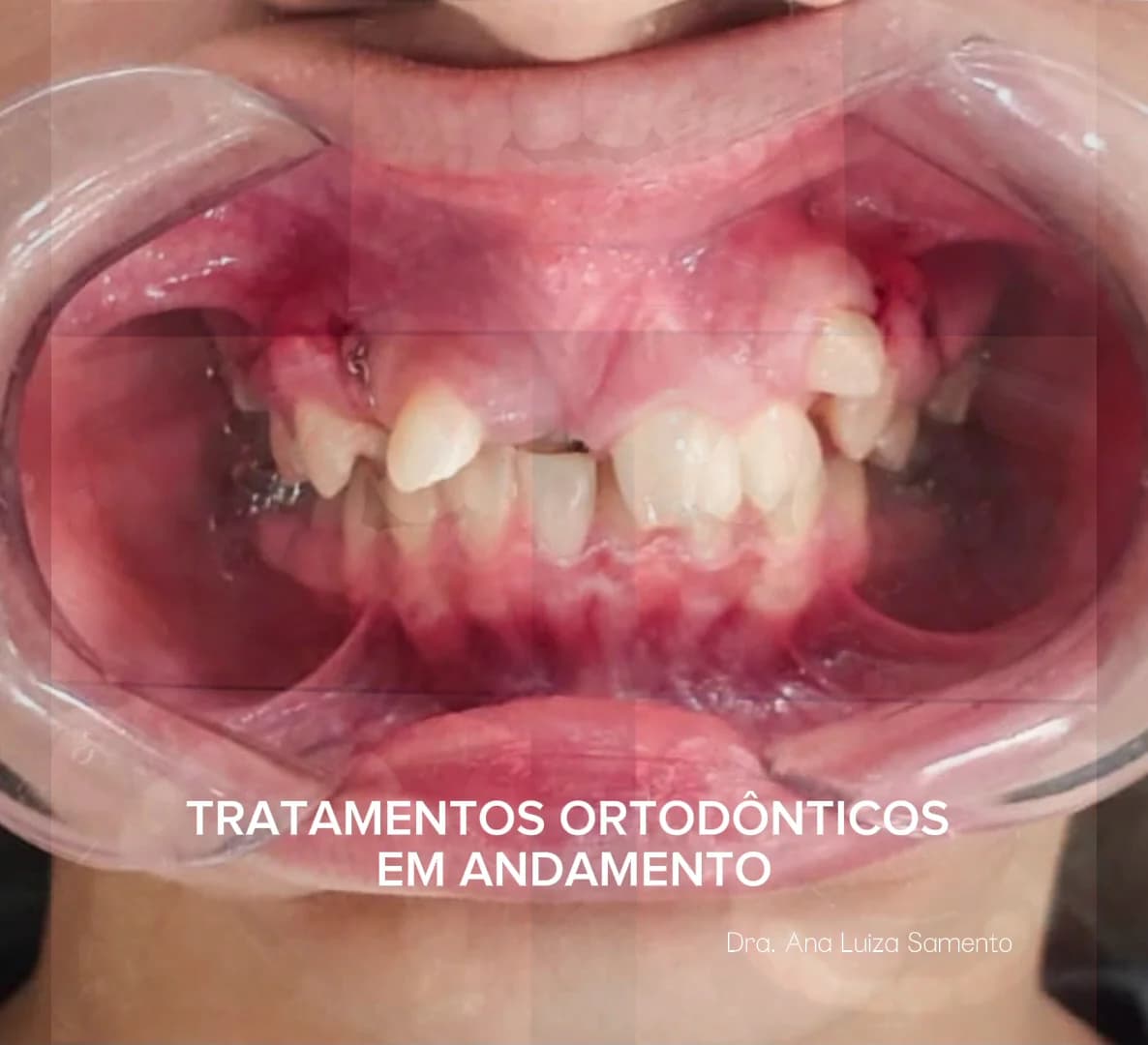 Consultório Odontológico Dra Ana Luiza | Ortodontia | Odontopediatria | Dentista em Ananindeua - Cidade Nova – foto 2