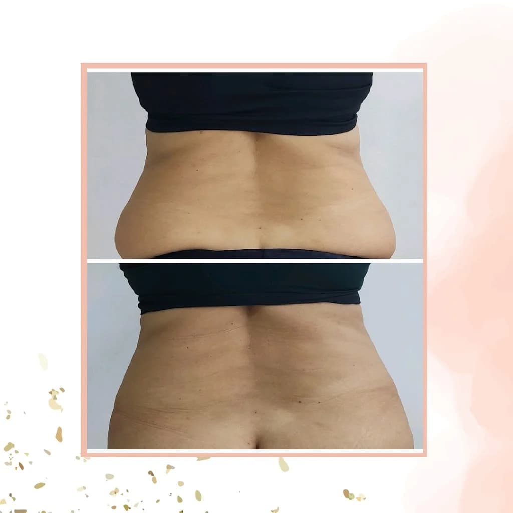 Manoela Pacífico - Clínica de Estética em Camaçari – foto 3