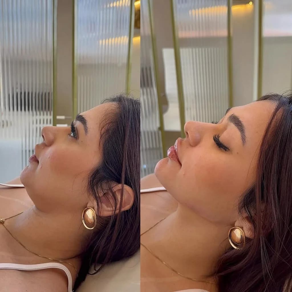 Doutora Esteta | Harmonização Facial – foto 2