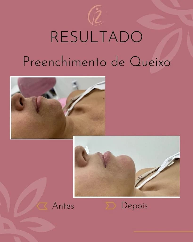 Revitalize Estética e Bem-estar, Clínica de Estética Avançada – foto 1