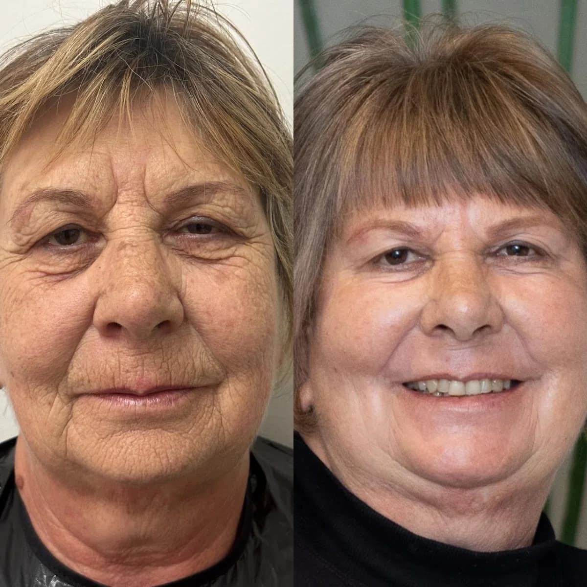 Clínica de Estética Avançada Dra Cris Assunção I Ponta Grossa Centro – foto 1