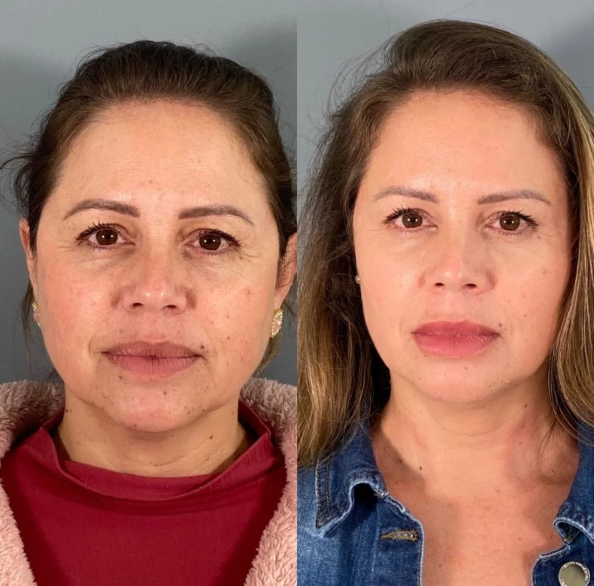 Clínica de Estética Avançada Dra Cris Assunção I Ponta Grossa Centro – foto 3