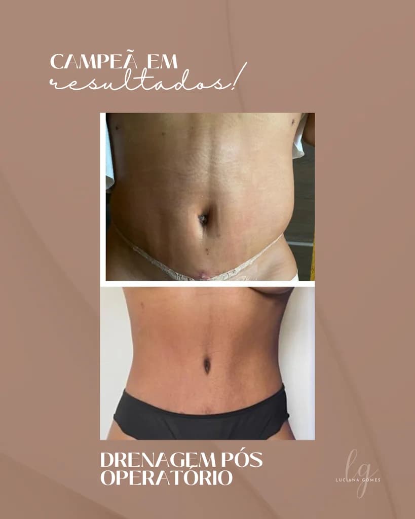 Clínica Estética Dra Luciana Gomes em Contagem, Limpeza de Pele, Lipo Papada, Criolipólise, Tratamento de Flacidez, Drenagem – foto 2