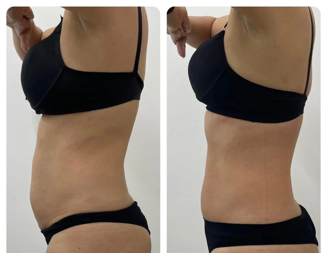 Clínica Estética Dra Luciana Gomes em Contagem, Limpeza de Pele, Lipo Papada, Criolipólise, Tratamento de Flacidez, Drenagem – foto 3