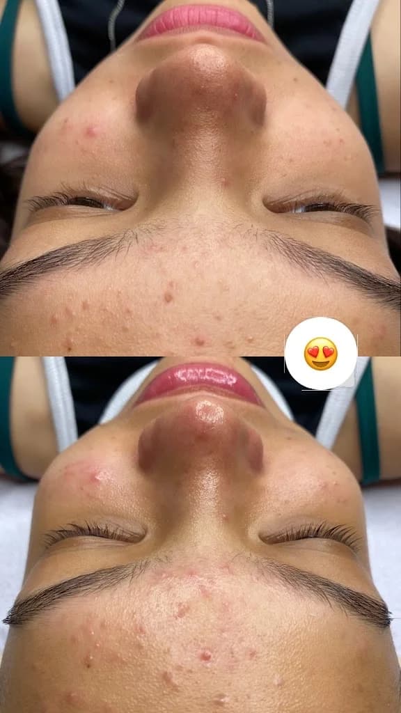 Estética avançada - Naiane Freitas – foto 2
