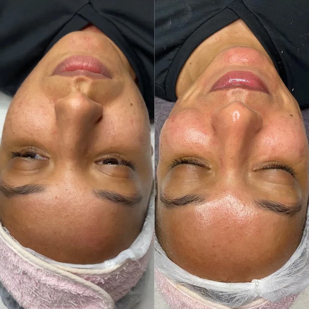 Estética avançada - Naiane Freitas – foto 3