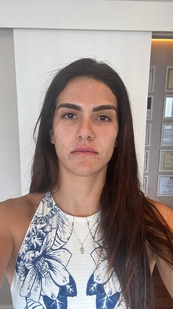 Dra. Anuska Lima | Harmonização Facial e Ortodontia em Salvador – foto 3
