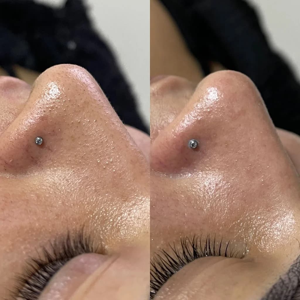 Laura Santos - Estética Avançada e Tricologia | Limpeza de pele | Secagem de vasinhos | Peeling químico | Tratamento capilar – foto 3