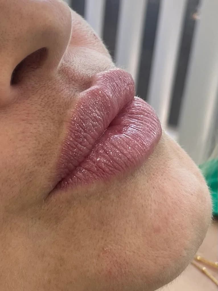 Dra. Asheley Tinoco - Harmonização Facial | Campos dos Goytacazes, Rj – foto 2