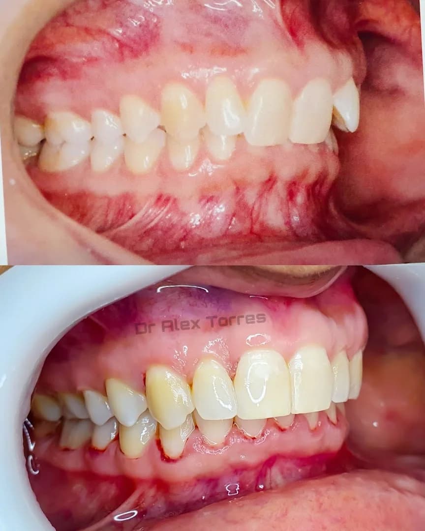 Dr. Alex Torres - ImplanteJá – foto 1