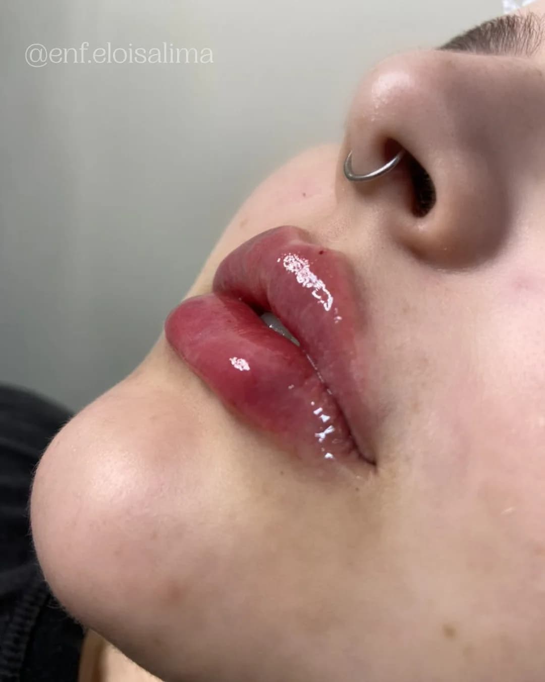 Dra. Eloisa Lima Garcia | Estética Avançada – foto 1