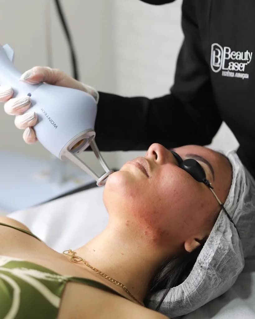 Beauty Laser | Clínica de Estética Avançada em Ipatinga – foto 1