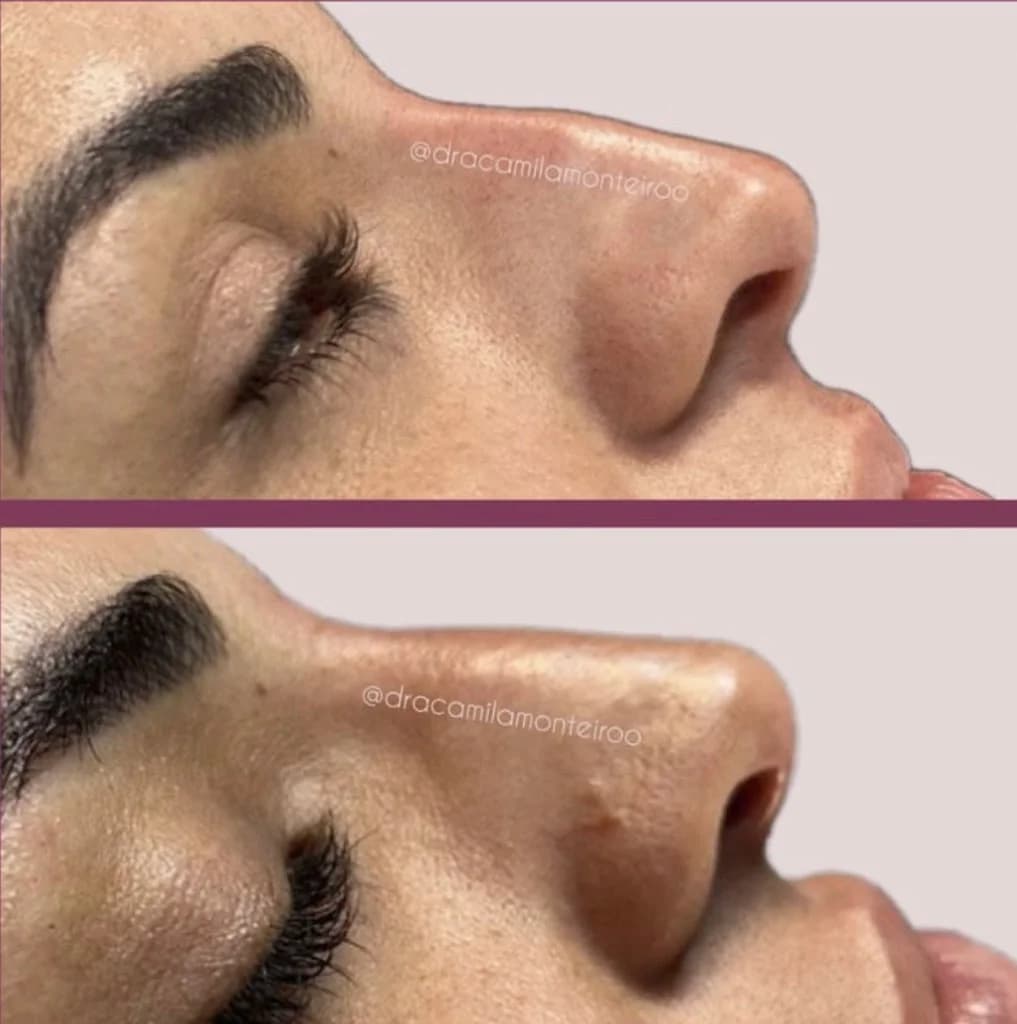 Dra. Camila Monteiro - Harmonização Facial Campos dos Goytacazes – foto 3