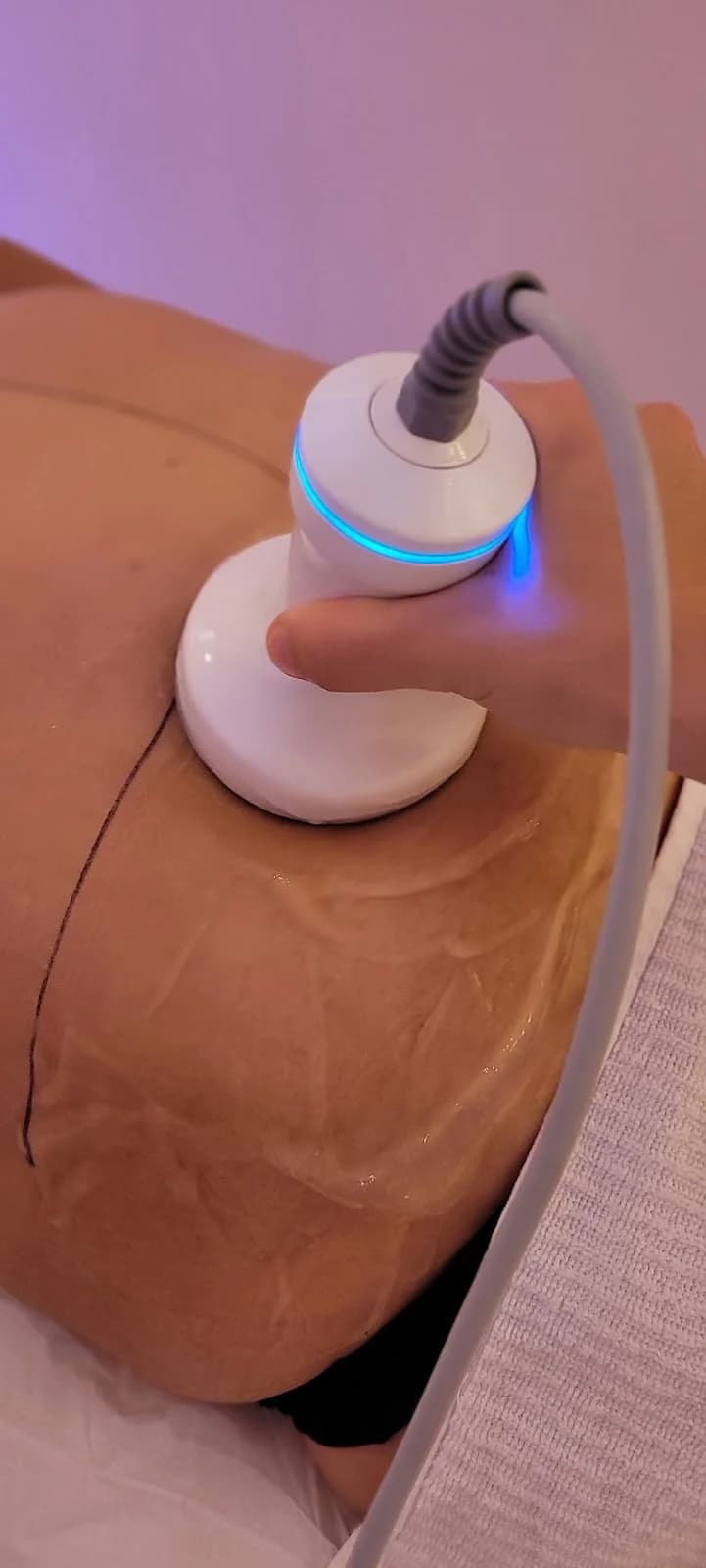 Danieli Santos - Estética e Massoterapia avançada – foto 3