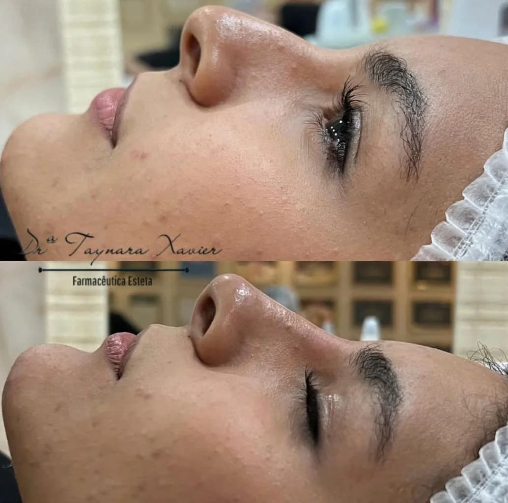 Clínica Drª Taynara Xavier Harmonização Facial & Corporal – foto 3
