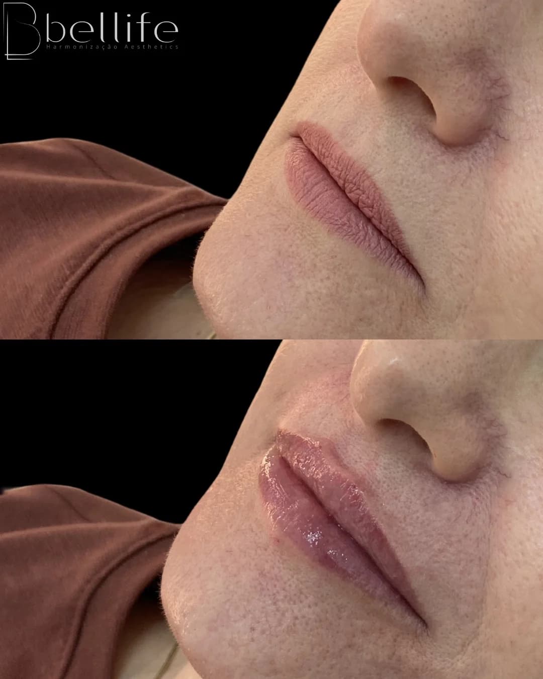 Clinica de Estética Bellife Maringá – foto 3