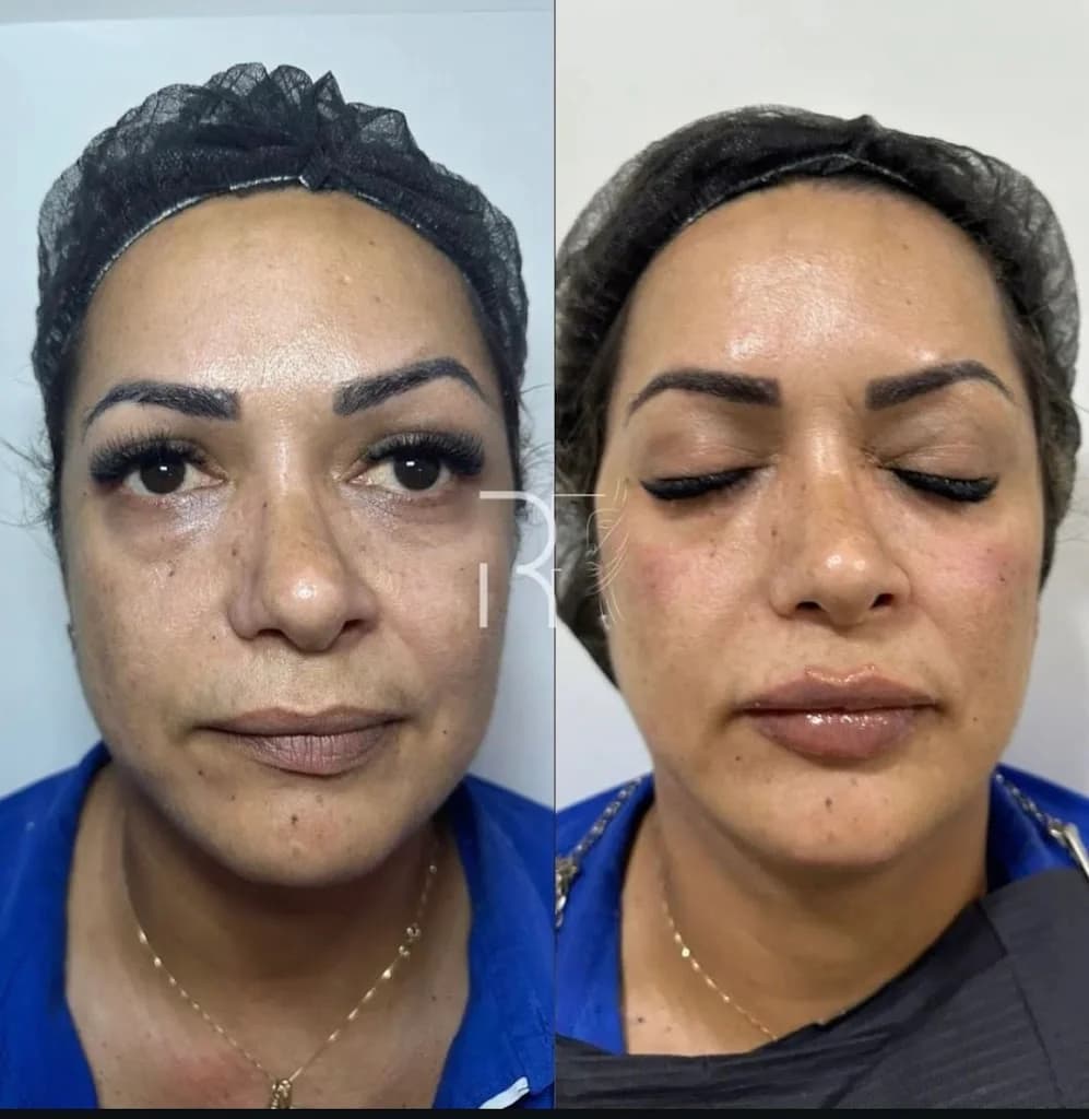 Dra Raiana Felipe - Harmonização Orofacial – foto 1