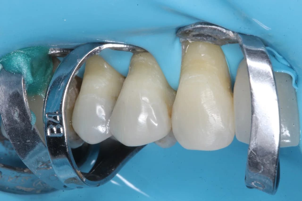 BIOIMPLANTES Clínica Odontológica – foto 2