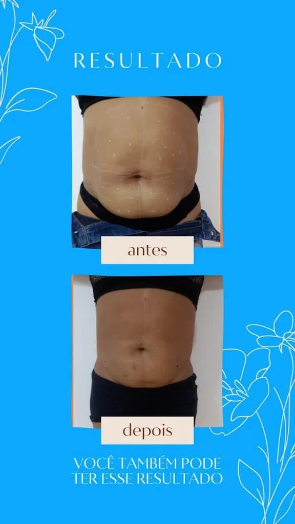 š»ā Clinica de emagrecimento e Harmonização facial em Ananindeua - Dra. Alynne AlcĆ¢ntara ā foto 2