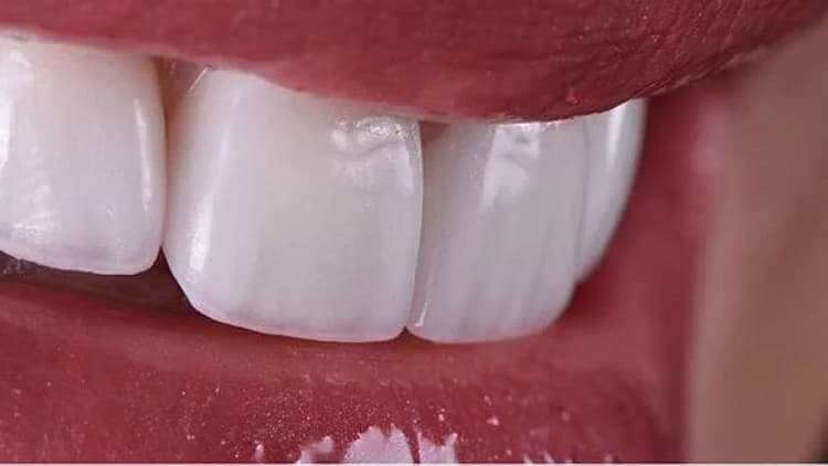 Dr. Ricardo Lippo Dentista Recife – foto 1