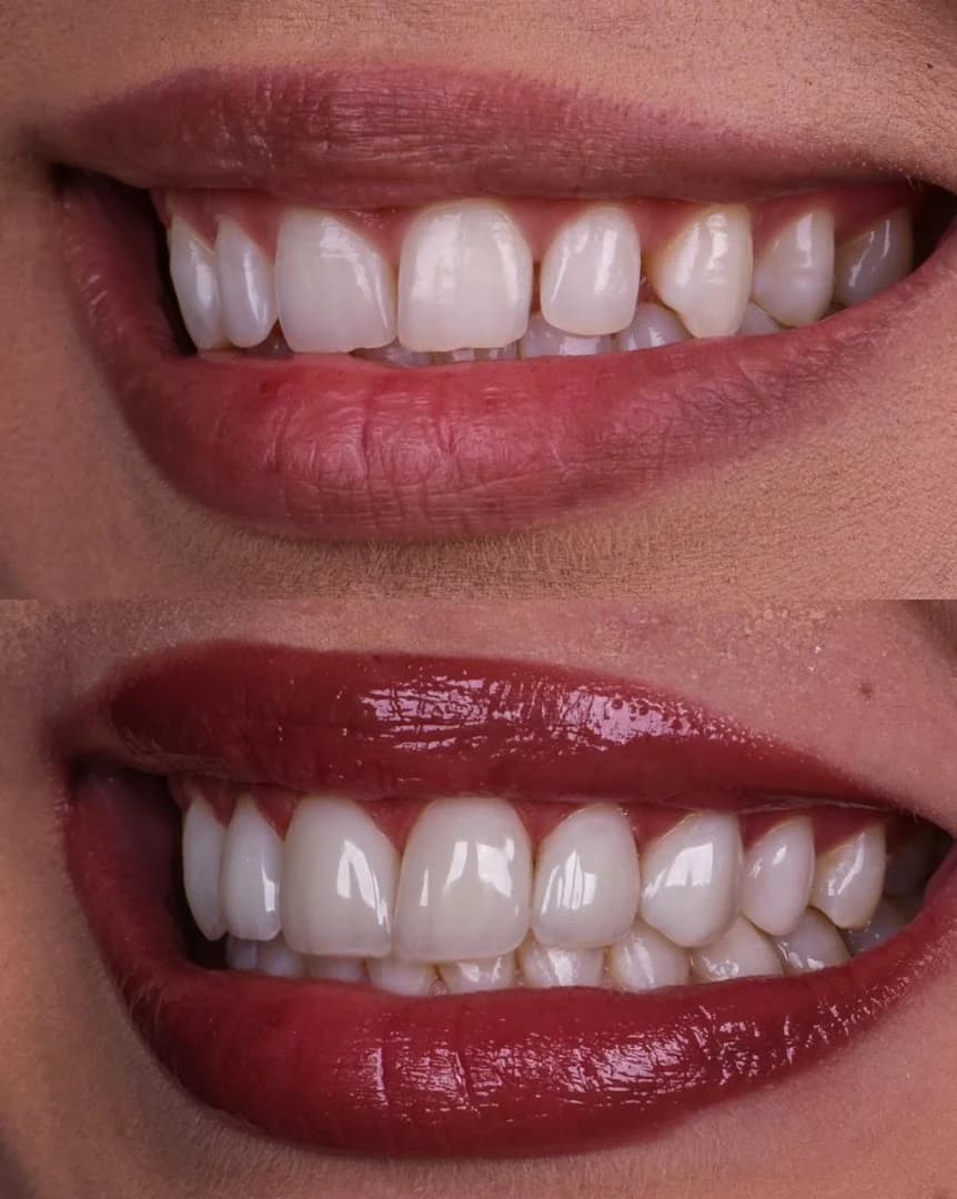 Dr. Ricardo Lippo Dentista Recife – foto 2