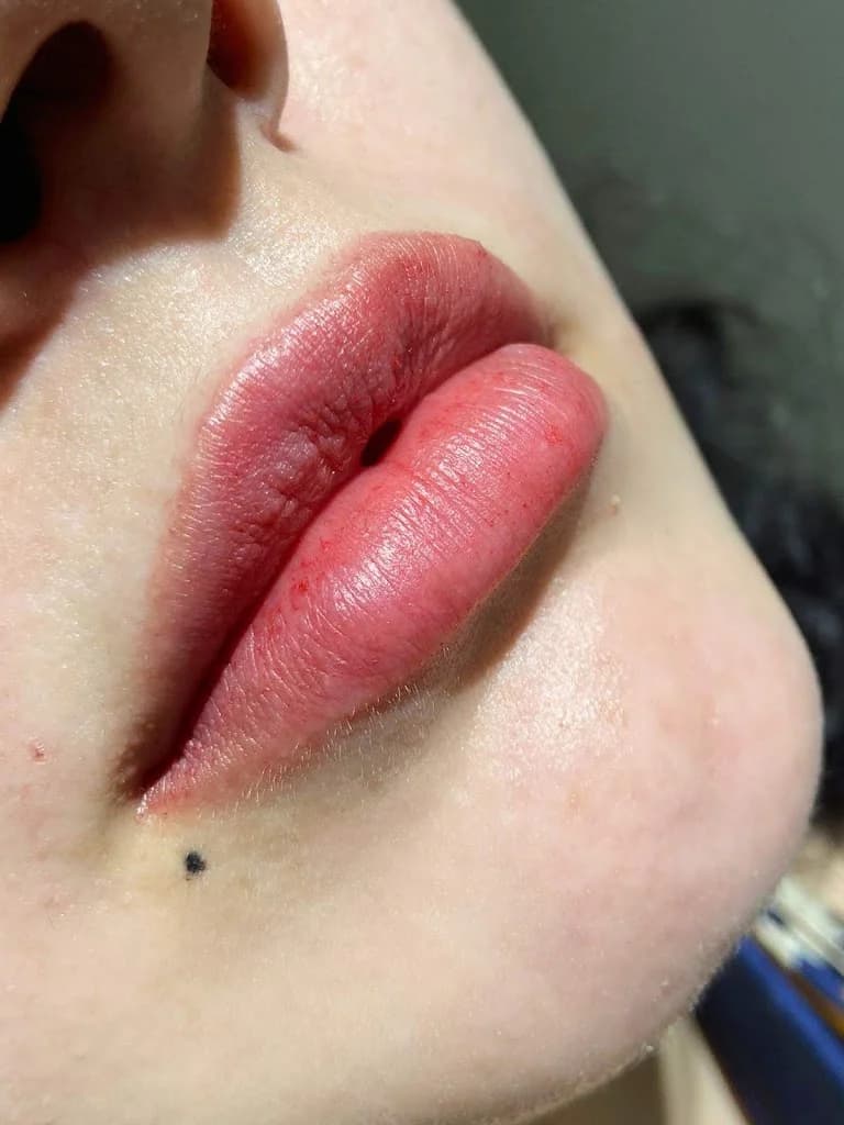 Clínica Amonite - Harmonização Facial e Corporal - Paranaguá – foto 2