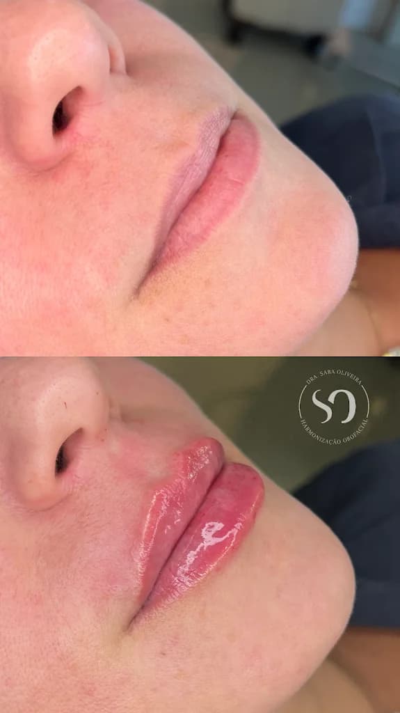 Dra Sara Oliveira Harmonização Facial em Salvador – foto 2