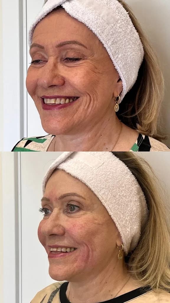 Dra. Caroline Jardim • Harmonização Facial em Canoas – foto 3