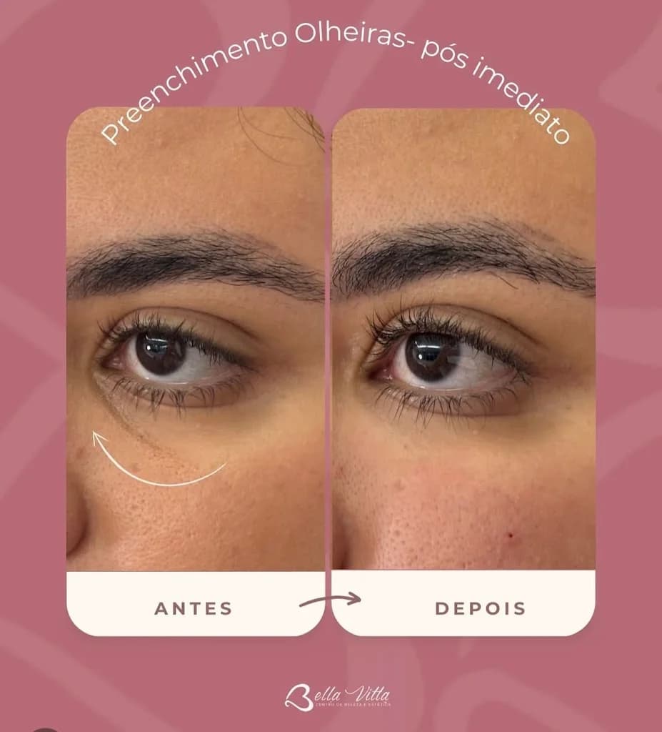 Clínica de Estética Avançada - BellaVitta | Rejuvenescimento Facial – foto 2