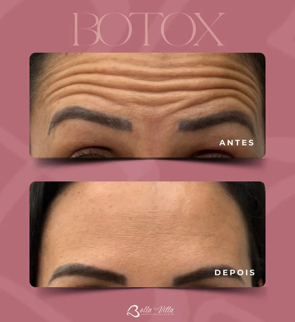 Clínica de Estética Avançada - BellaVitta | Rejuvenescimento Facial – foto 3