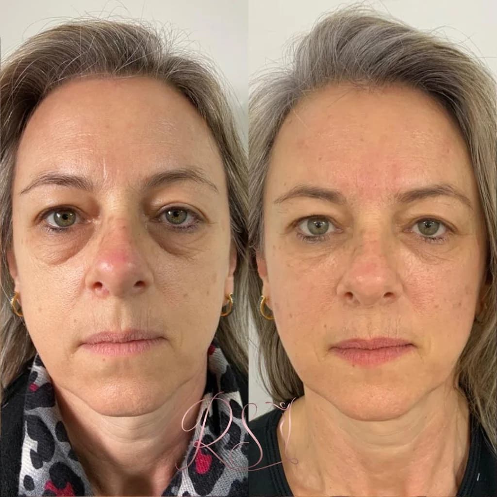 Dra. Roberta Straccioni - Especialista em Harmonização Facial – foto 3