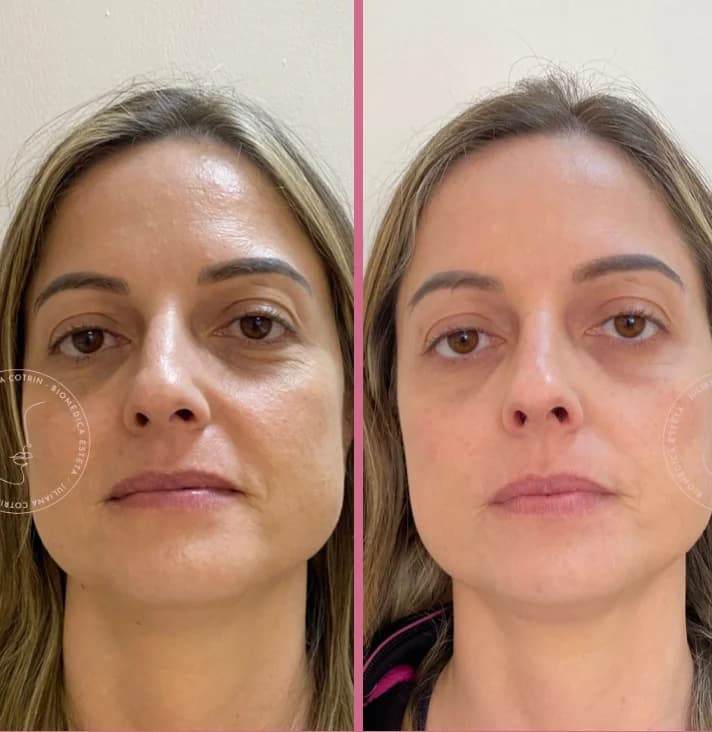 Harmonização facial e Saúde Estética - Dra Juliana Cotrin – foto 3