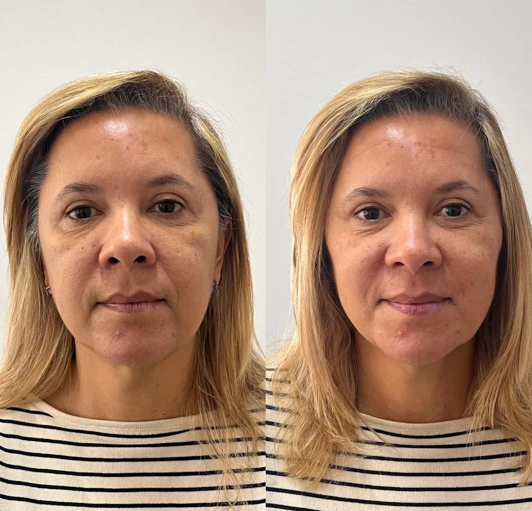 Dra Dayana Ferreira - Harmonização Facial • Laser Pisom - Centro Rio de Janeiro – foto 3