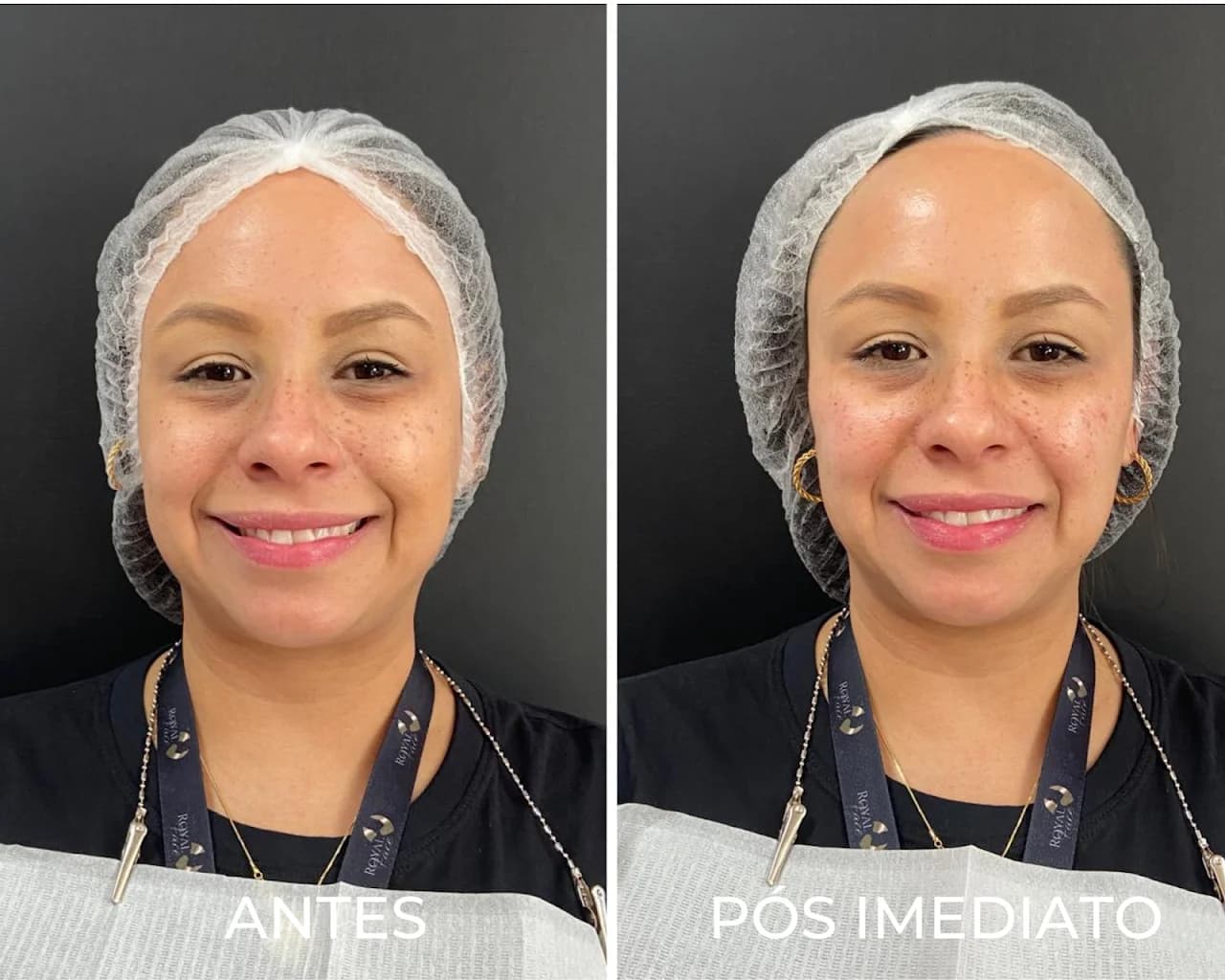 Royal Face Clínica de Estética - Campos dos Goytacazes – foto 2