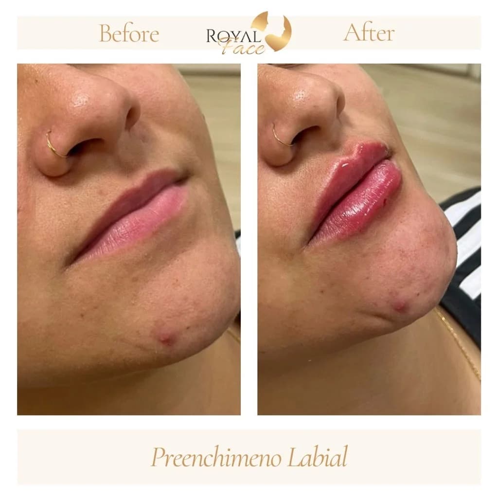 Royal Face Clínica de Estética - Campos dos Goytacazes – foto 3