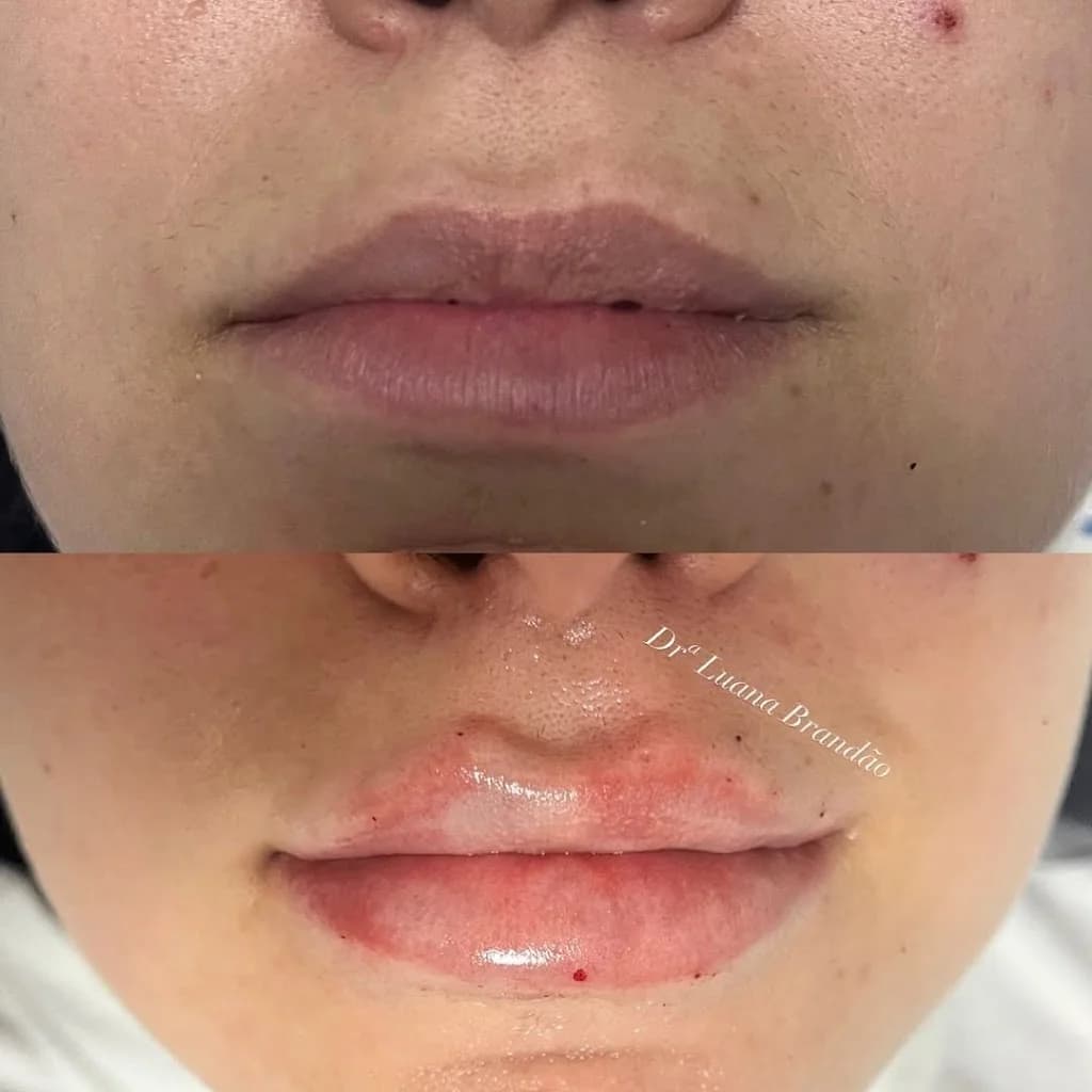 Dra. Luana Brandão | Harmonização Facial – foto 2