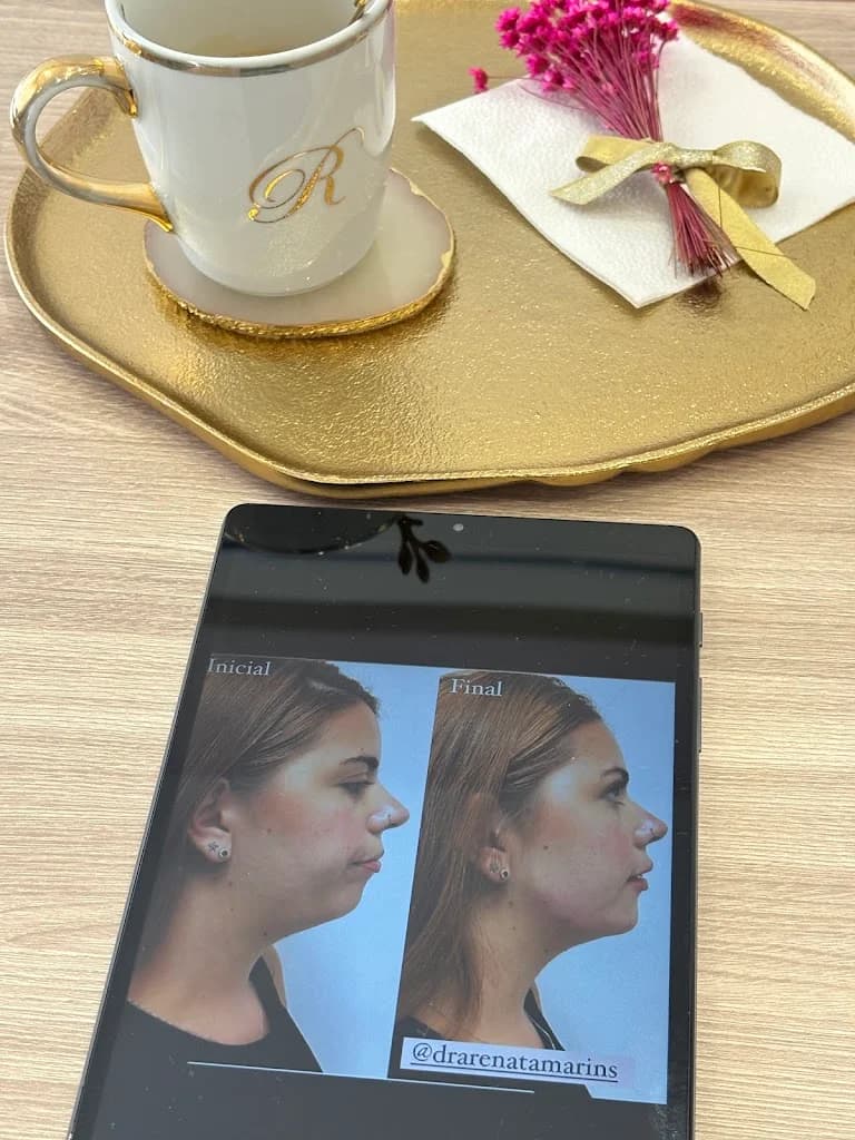 Dra. Renata Marins, Especialista em Harmonização Facial Natural – foto 3