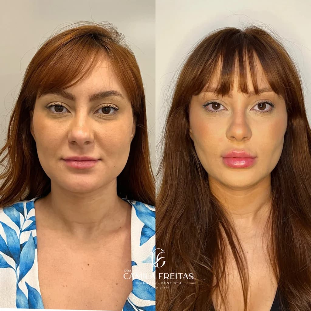 Dra Camila Freitas - Harmonização Facial – foto 3