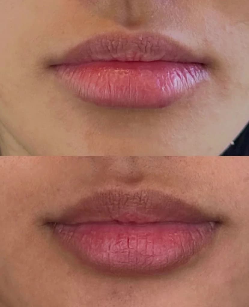 Clínica Estética Avançada GF Uberlândia Facial Corporal e Capila – foto 2