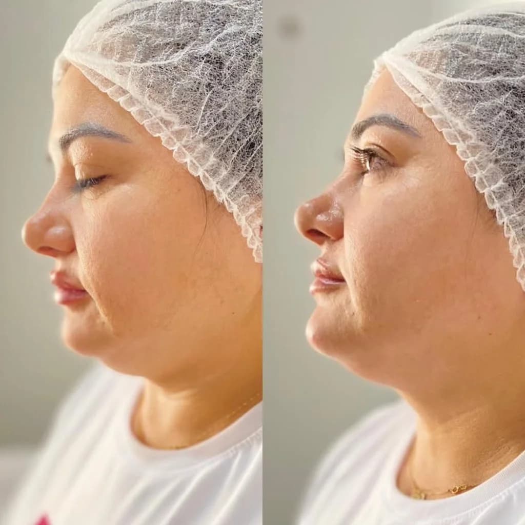 LôAlves - Harmonização Facial e Corporal | Parauapebas – foto 2