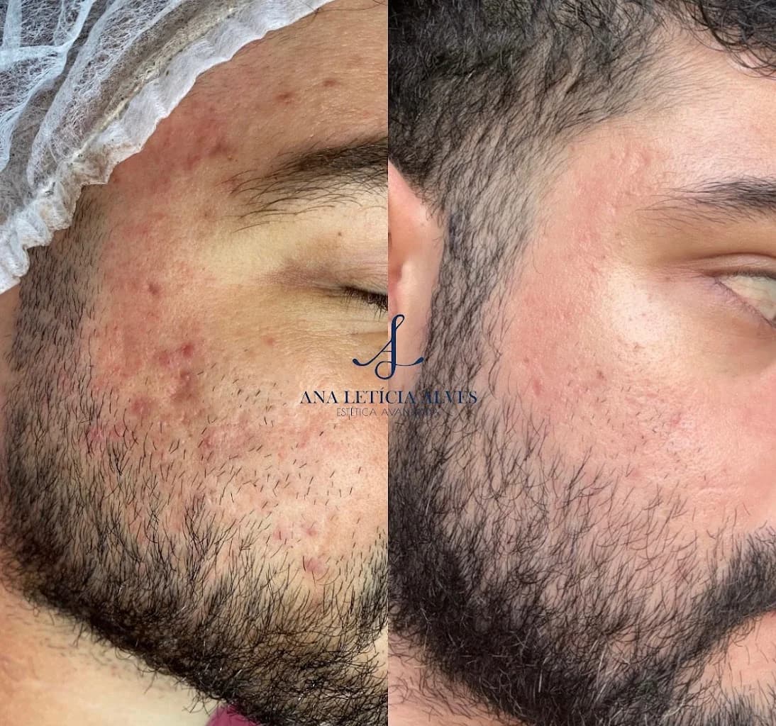 Clínica Ana Letícia Alves - Estética Avançada Facial – foto 2