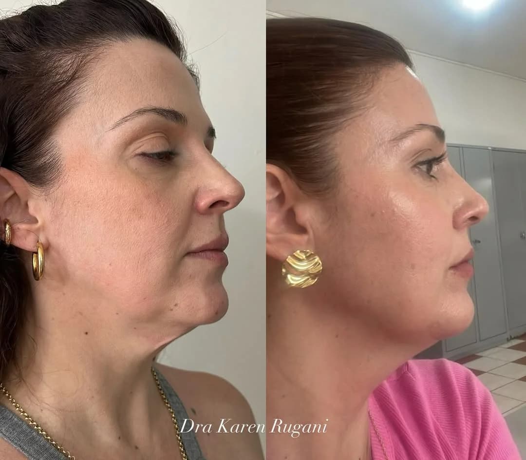 Dra Karen Rugani | Harmonização Facial e Corporal – foto 3